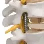 Colonne vertébrale flexible avec support