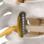 Colonne vertébrale flexible pour la forte sollicitation, avec des moignons de fémur A59/2