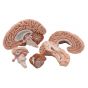 Cerveau classique en 5 parties C18 3B Scientific