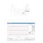 ECG portable Beurer ME 80 avec Logiciel PC