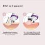 Microdermabrasion Beurer FC 76