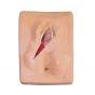 Suture post-épisiotomie, 3 pièces W44096