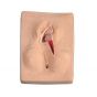 Suture post-épisiotomie, 3 pièces W44096