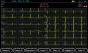 Pack promo ECG Spengler Cardiomate 3 (3 pistes) avec interprétation