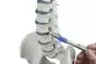 Modèle de colonne vertébrale avec hernie discale et bassin amovible sans socle 4024 Erler Zimmer