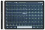  Electrocardiographe ECG Cardiomate EVI  (12 pistes) avec interprétation Spengler