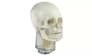 Fantôme radiographique de tête avec vertèbres cervicales Erler Zimmer