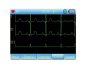 Electrocardiographe portable ECG Contec 90A 3 pistes avec interprétation