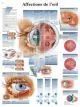 Planche anatomique Affections de l'œil VR2231UU