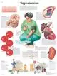 Planche anatomique L'hypertension VR2361L