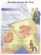 Planche anatomique Incontinence urinaire chez la femme VR2542L