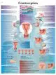 Planche anatomique Contraception VR2591UU