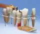 Modèle de prothèse dentaire, en 7 parties, agrandie 10 fois - Allemand W42528