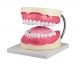 Modèle de soins dentaires agrandi 3 fois Erler Zimmer D216