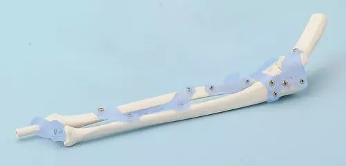 Modèle d'articulation du coude avec ligaments 4557 Erler Zimmer