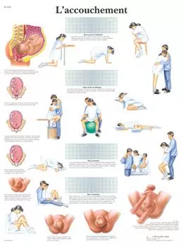 Planche anatomique L'accouchement VR2555UU