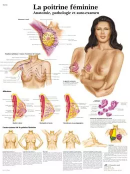 Planche anatomique La poitrine féminine - Anatomie, pathologie et auto-examen VR2556UU