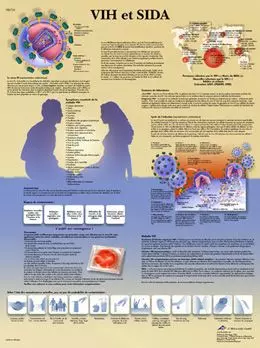 Planche anatomique VIH et SIDA VR2725L
