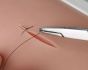 Simulateur de suture de la peau 7060 Erler Zimmer