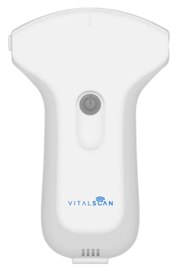 Echographe ultraportable connecté Vital Scan X3