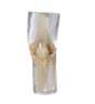 Fantôme radiographique du genou Erler Zimmer transparent