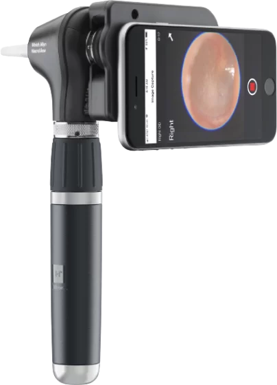 Otoscope LED Macroview 2 Plus iExaminer Welch Allyn