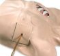 Mannequin de simulation de drainage pleural LF03770U Nasco