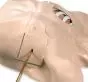 Mannequin de simulation de drainage pleural LF03770U Nasco