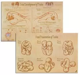 Affiche «Développement fœtal et présentation de jumeaux» 3B Scientific W43094