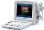 Echographe portable à ultrasons Edan U50 (couleur)