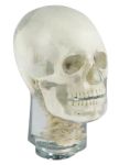 Fantôme radiographique de tête avec vertèbres cervicales Erler Zimmer