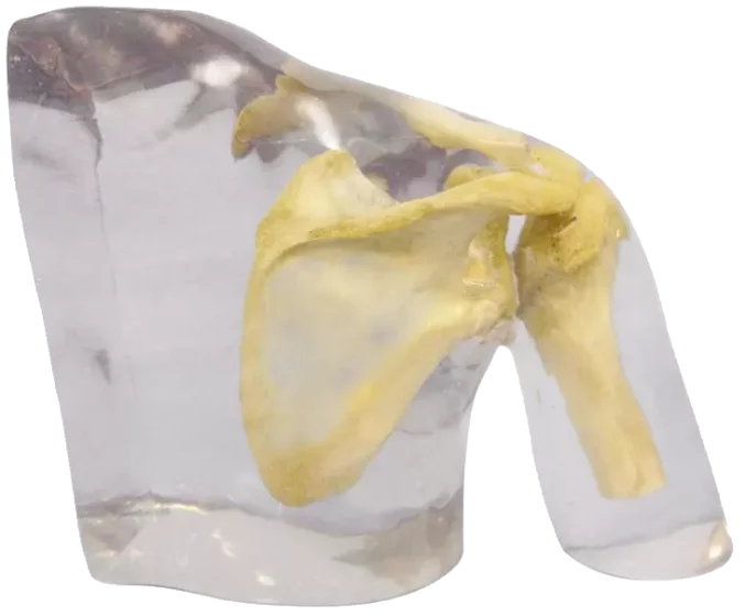 Fantôme radiographique de l'épaule Erler Zimmer