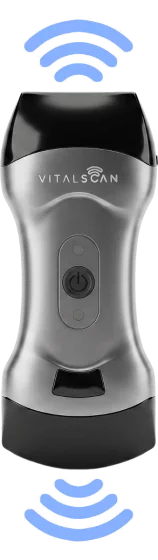 Echographe ultraportable connecté Vital Scan X5