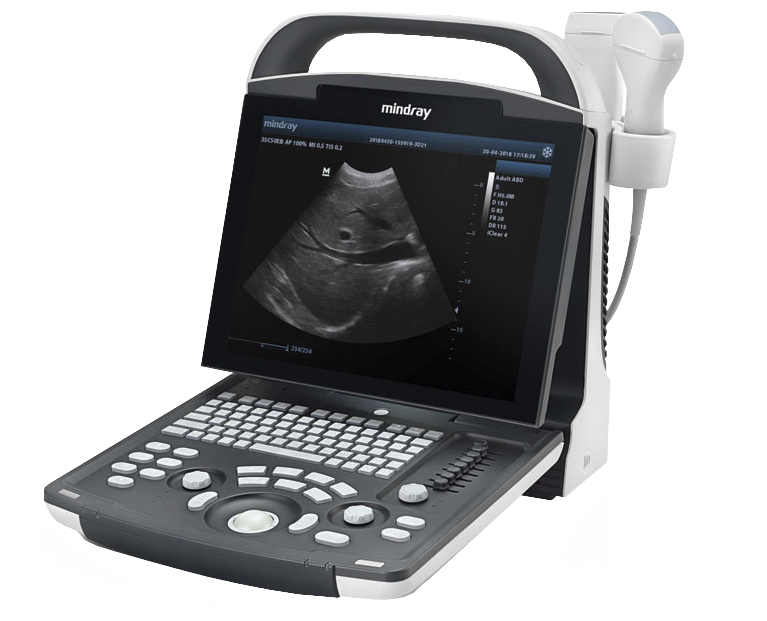 ultrason +appareil intellect mobile +appareil ultrason+appareil kiné
