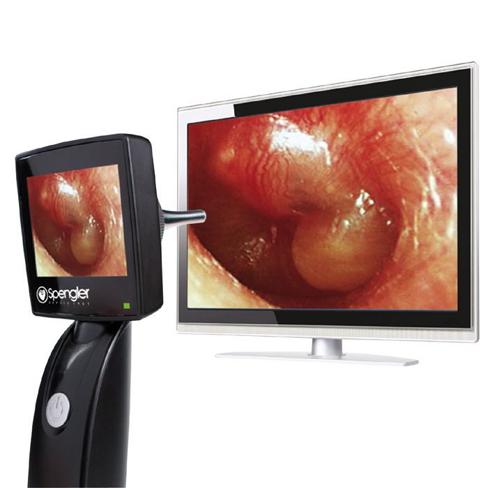 Otoscope vidéo sans fil - CONSOMED