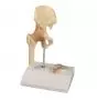 Articulation miniature de la hanche avec coupe transversale Erler Zimmer