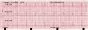 Electrocardiographe ECG Vétérinaire Edan VE300 (3 pistes)