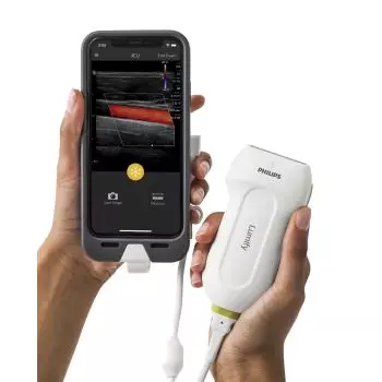 Dispositif d’échographie Philips Lumify pour iOS