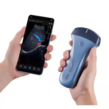 Echographe ultraportable connecté Edan Nano pour smartphone et tablette (couleur)