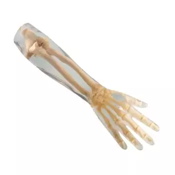 Fantôme radiographique avant-bras Erler Zimmer