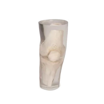 Fantôme radiographique du genou Erler Zimmer transparent