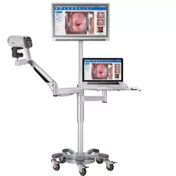 Vidéo Colposcope Edan C6A HD standard avec chariot T shape