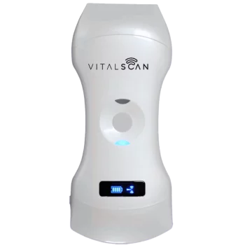 Echographe ultraportable connecté Vital Scan X5