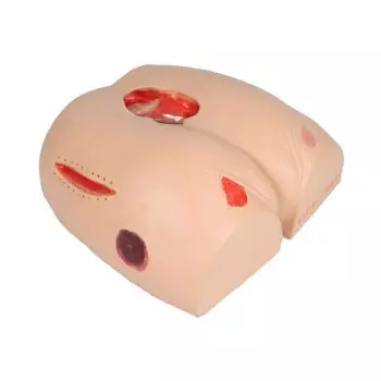 Simulateur d‘escarres Erler Zimmer