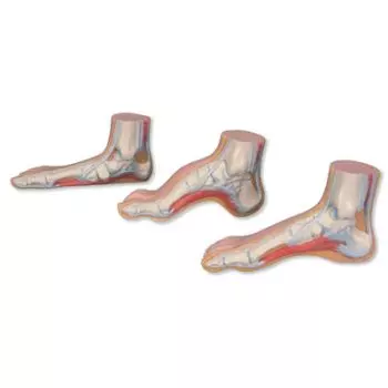 Série de pieds MEDart™– Pied normal, pied plat, pied creux MAM33