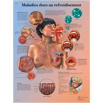 Planche anatomique Maladies dues au refroidisement VR2253L