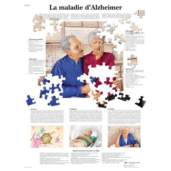 Planche anatomique PM La maladie d'Alzheimer VR2628L