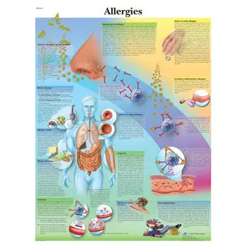 Planche anatomique Allergies VR2660UU