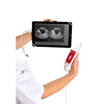 Scanner vésical Vitascan Vitacon 