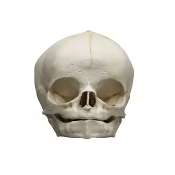 Crâne d´un foetus, 40ième semaine Erler Zimmer 4745
